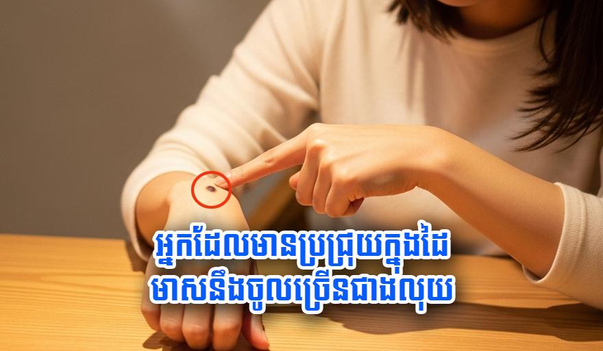ប្រជ្រុយលើដៃ៖ មាសប្រាក់ហូរចូល! តើប្រជ្រុយនាំលាភសំណាងរបស់អ្នកនៅត្រង់ណា?