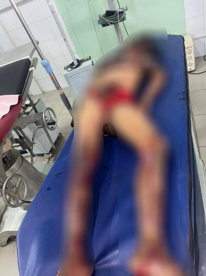 គ្រោះថ្នាក់ដ៏សែនឈឺចាប់! ក្មេង២នាក់ស្លាប់ក្រោមស្ពានដោយសារគ្រាប់មិនទាន់ផ្ទុះ