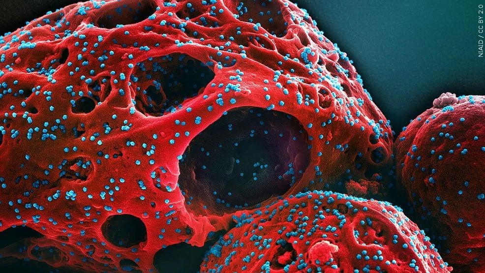 ថៃរកឃើញកូវីដប្រភេទថ្មី ‘Cicada’ ដែលឆ្លងខ្លាំង និងគេចផុតពីប្រព័ន្ធភាពស៊ាំ