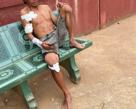 ឧប្បត្តិហេតុផ្ទុះយុទ្ធភ័ណ្ឌមិនទាន់ផ្ទុះនៅបាត់ដំបង បណ្ដាលឲ្យបុរសម្នាក់របួសធ្ងន់