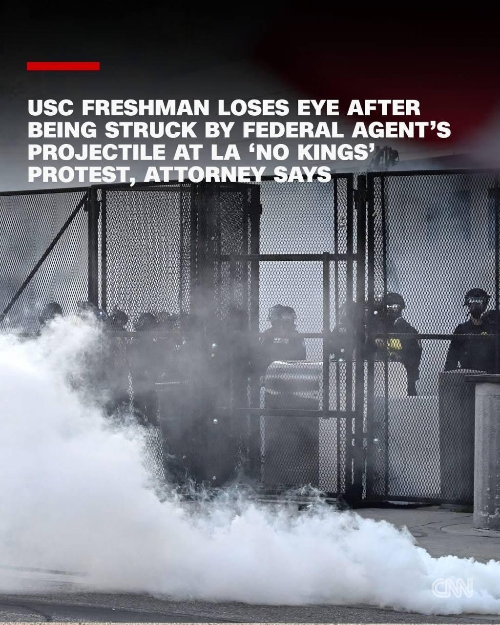 និស្សិត USC បាត់ភ្នែកបន្ទាប់ពីត្រូវគ្រាប់ផ្លោងរបស់ភ្នាក់ងារសហព័ន្ធក្នុងការតវ៉ា ‘No Kings’ នៅ LA