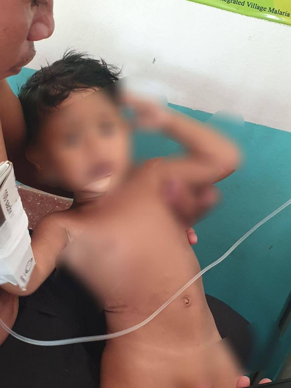 រន្ទះបាញ់នៅផ្ទះលំហែសៀមរាប បណ្ដាលឱ្យមនុស្ស៤នាក់រងរបួស